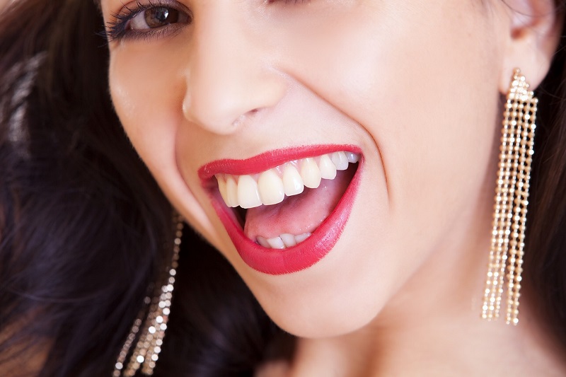 Dental Implants happy lady smiling