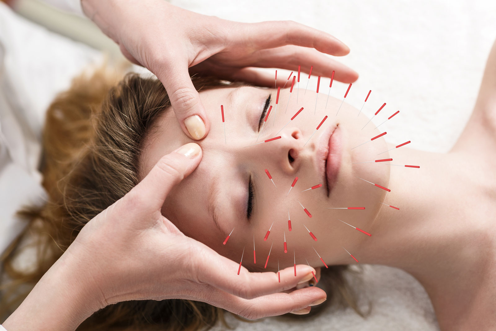 Know About Acupuncture