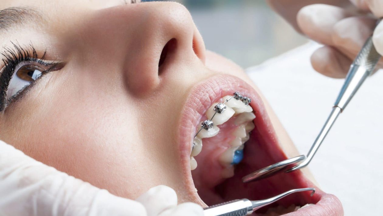 5 Signs You Should Visit an Orthodontist Near You