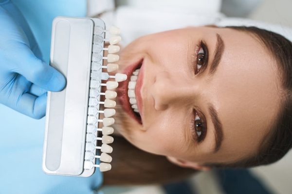 The Benefits of Dental Veneers: A Comprehensive Guide
