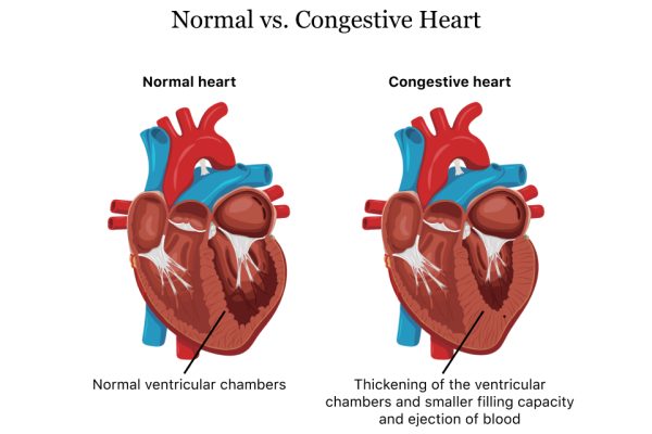 Normal-vs.-Congestive-Heart